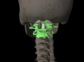 Free download 1024px Finger Luxation D 5 MCP 1024x 670 free photo or picture to be edited with GIMP online image editor