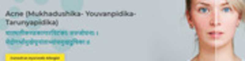 Free download Acne Treatment free photo or picture to be edited with GIMP online image editor