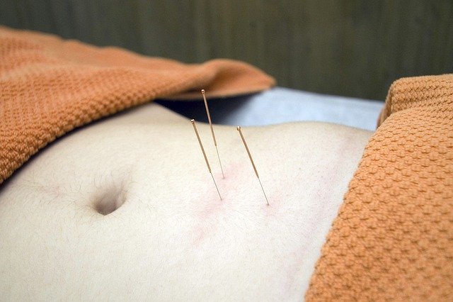 Free download Acupuncture Physiotherapy Wellness -  free photo or picture to be edited with GIMP online image editor