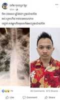 Free download An Indonesian man dies of Covid-19, a claim says free photo or picture to be edited with GIMP online image editor