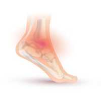 Free download Ankle Sprain free photo or picture to be edited with GIMP online image editor
