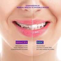 Free download Braces Vs Invisalign free photo or picture to be edited with GIMP online image editor