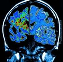 Free download Brain Scan free photo or picture to be edited with GIMP online image editor