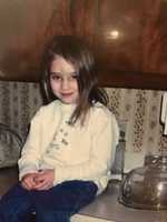 Free download Callies Big Bruise free photo or picture to be edited with GIMP online image editor