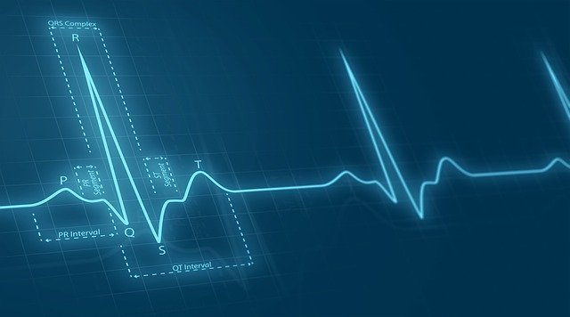 Free download Cardiac Pulse Time Series -  free photo or picture to be edited with GIMP online image editor