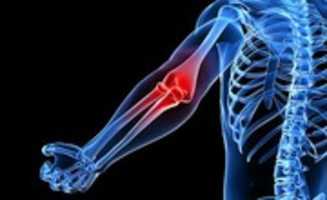 Free download Carpal tunnel syndrome Houston free photo or picture to be edited with GIMP online image editor