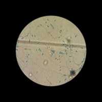 Free download Colletotrichum sp. free photo or picture to be edited with GIMP online image editor