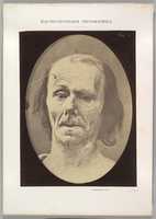 Free download Figure 9: A study of m. frontalis in maximum contraction free photo or picture to be edited with GIMP online image editor