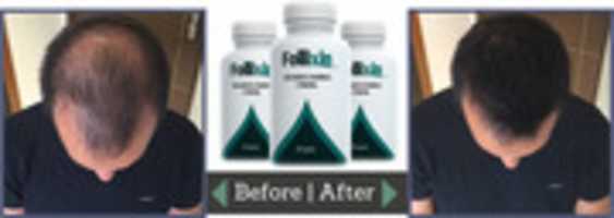 Free download Follixin Results free photo or picture to be edited with GIMP online image editor