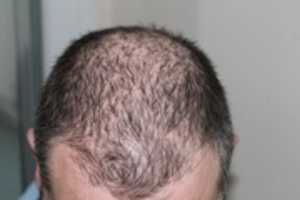 Free download hair-248050_960_720 free photo or picture to be edited with GIMP online image editor