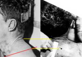 Free download JFK Back Wound free photo or picture to be edited with GIMP online image editor