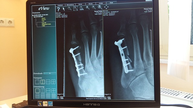 Free download roentgen x ray image clinic free picture to be edited with GIMP free online image editor