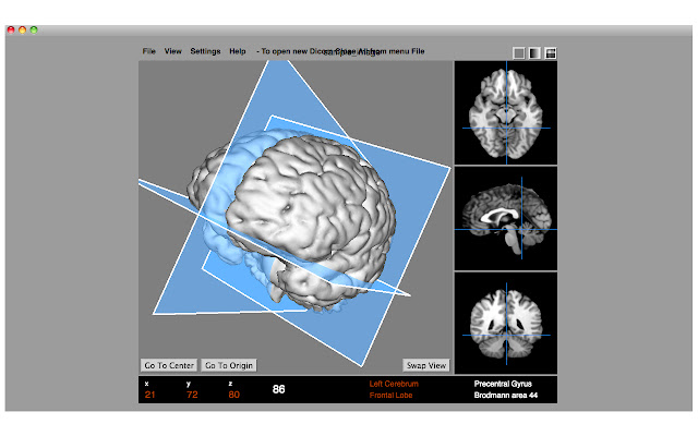 Dicom Medical Image Viewer  from Chrome web store to be run with OffiDocs Chromium online