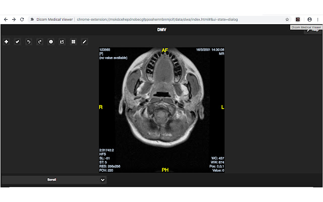 Dicom Medical Viewer din magazinul web Chrome va fi rulat cu OffiDocs Chromium online