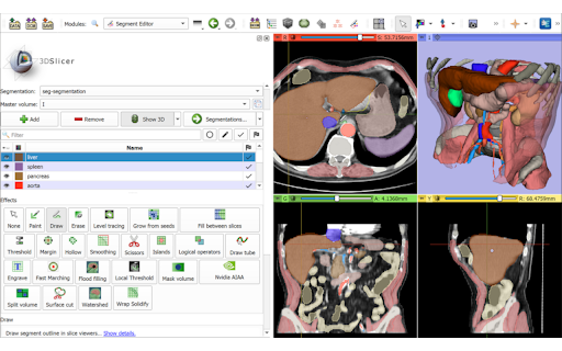 Kitware File Viewers  from Chrome web store to be run with OffiDocs Chromium online