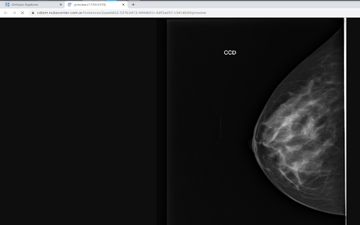 Orthanc Instance2Image  from Chrome web store to be run with OffiDocs Chromium online
