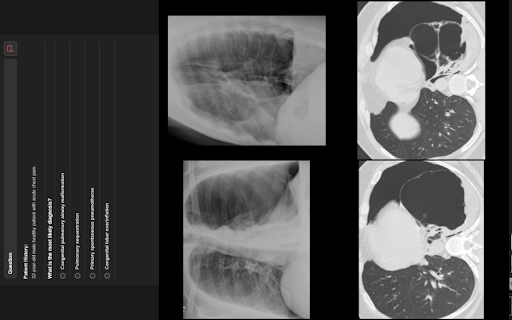 RADPrimer with Enhancement  from Chrome web store to be run with OffiDocs Chromium online