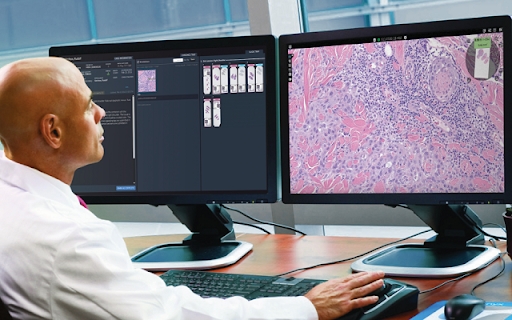 Synapse Pathology Workflow Extension  from Chrome web store to be run with OffiDocs Chromium online
