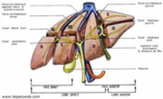 Free download segmentation_hepatique free photo or picture to be edited with GIMP online image editor