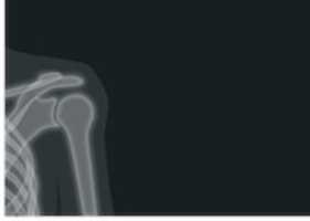 Free download Shoulder 12 free photo or picture to be edited with GIMP online image editor