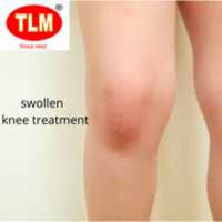 Free download Swollen Knee Treatment free photo or picture to be edited with GIMP online image editor