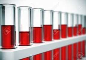 Free download 16452083 Glass Laboratory Chemical Test Tubes With Red Liquid Or Blood Selective Focus Effect Stock Photo free photo or picture to be edited with GIMP online image editor