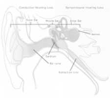 Free download 1 Parts Of The Ear E 1398355894446 free photo or picture to be edited with GIMP online image editor