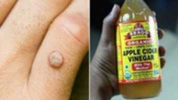 Free download Apple Cider Vinegar for Ulcers free photo or picture to be edited with GIMP online image editor