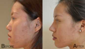 Free download Asian Nose Surgeon In LA free photo or picture to be edited with GIMP online image editor