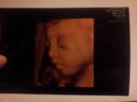 Free download Baby Girl free photo or picture to be edited with GIMP online image editor