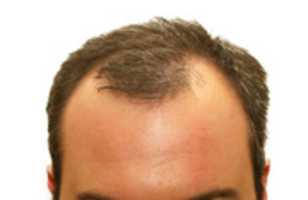 Free download balding-head-5300257 free photo or picture to be edited with GIMP online image editor