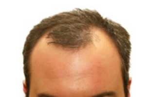 Скачать бесплатно balding-head-5300257 бесплатное фото или картинку для редактирования с помощью онлайн-редактора изображений GIMP