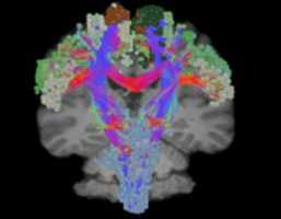 Free download Best gamma knife radiation treatment san antonio free photo or picture to be edited with GIMP online image editor