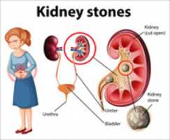 Free download Best Hospital For Kidney Stone Treatment In Chennai free photo or picture to be edited with GIMP online image editor