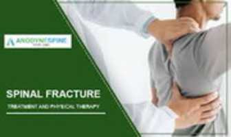 Free download Best Spine Alignment Treatment free photo or picture to be edited with GIMP online image editor
