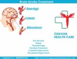 Free download #BrainStrokeTreatment free photo or picture to be edited with GIMP online image editor