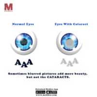 Free download Cataract Image free photo or picture to be edited with GIMP online image editor