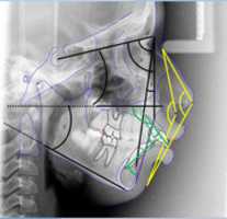 Free download cephalometry free photo or picture to be edited with GIMP online image editor