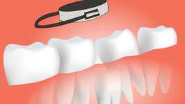 Kostenloser Download Dental Surgery Tooth - kostenloses Video, das mit dem Online-Videoeditor OpenShot bearbeitet werden kann
