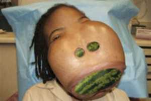 Free download Edit of a photo of a deformed black person free photo or picture to be edited with GIMP online image editor