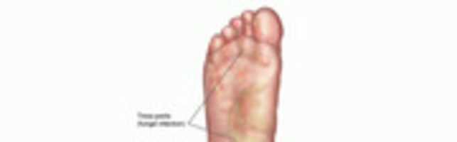 Free download Foot Doctor Long Beach free photo or picture to be edited with GIMP online image editor