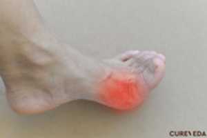 Free download Gout Supplements free photo or picture to be edited with GIMP online image editor