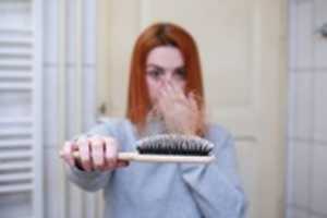 Free download hair-loss-4818761_960_720 free photo or picture to be edited with GIMP online image editor