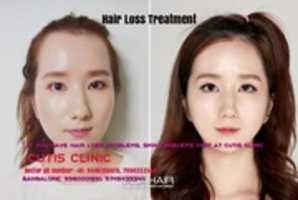 Free download Hair Transplantation Clinic free photo or picture to be edited with GIMP online image editor