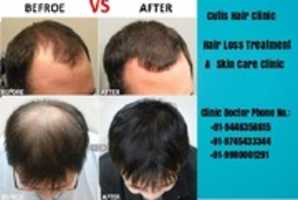 Free download Hair Transplantation Clinic Kochi free photo or picture to be edited with GIMP online image editor