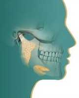 Free download Hair Transplants In Borivali West free photo or picture to be edited with GIMP online image editor