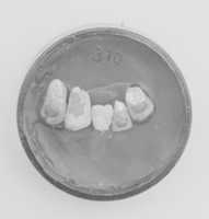 Free download Human teeth inlaid with jadeite free photo or picture to be edited with GIMP online image editor