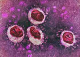 Free download Il Body Coronavirus 4 free photo or picture to be edited with GIMP online image editor