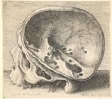 Free download Inner Aspects of the Human Skull free photo or picture to be edited with GIMP online image editor