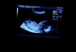 Free download Jan_3_ultrasound_small free photo or picture to be edited with GIMP online image editor
